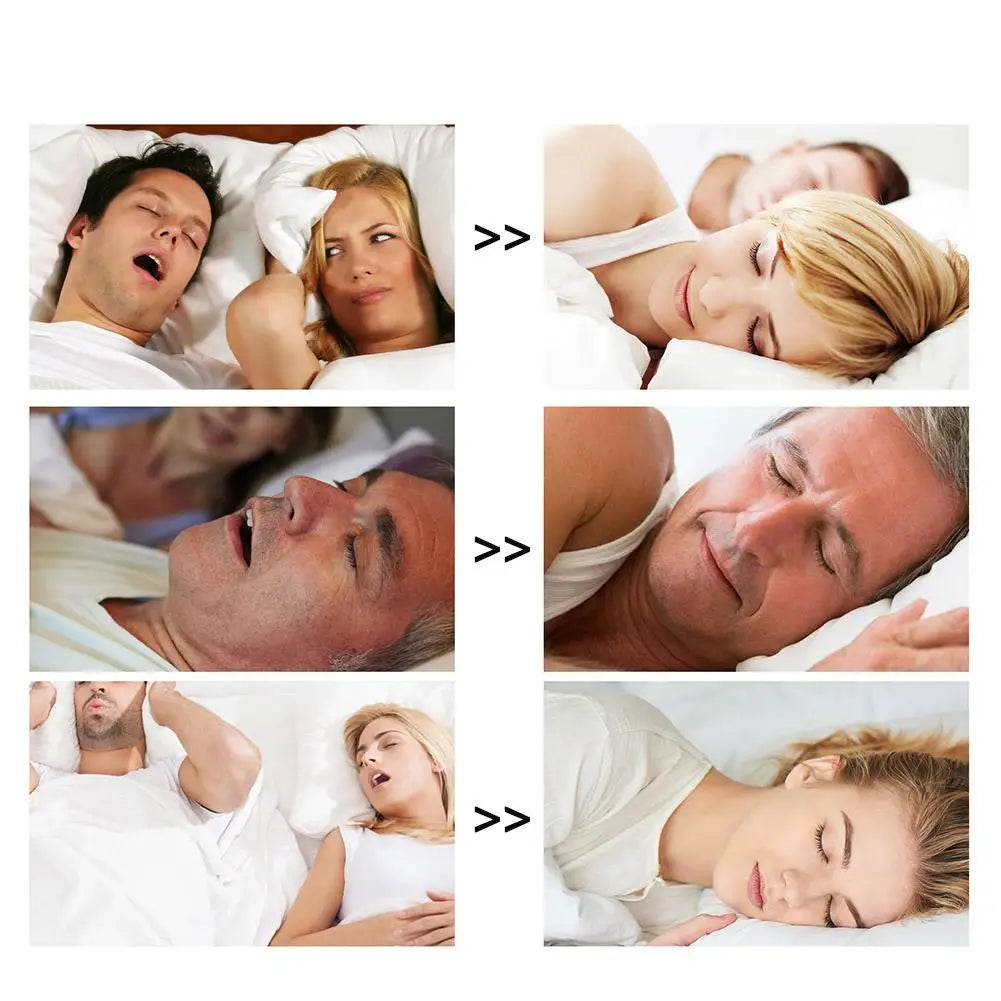 Nasal Strips (26pcs)